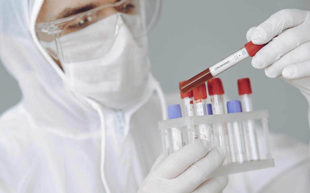 Κορονοϊός: Η Εθνική Ασφαλιστική μειώνει την τιμή εξέτασης για ανίχνευση του κορονοϊού